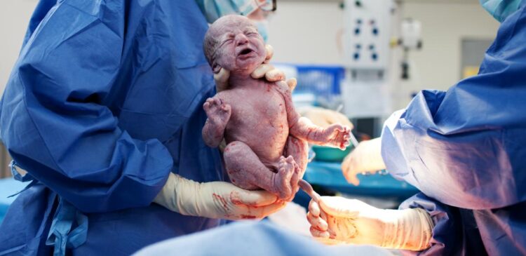 Quelle est la différence entre la péridurale et la rachianesthésie ?