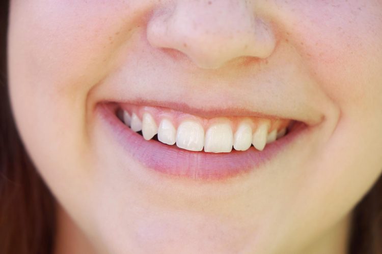 Comment blanchir ses dents naturellement