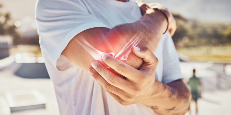 Préserver vos articulations de sportif : les bons compléments alimentaires