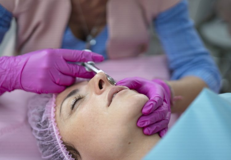 Acide hyaluronique dans le nez pour une rhinoplastie